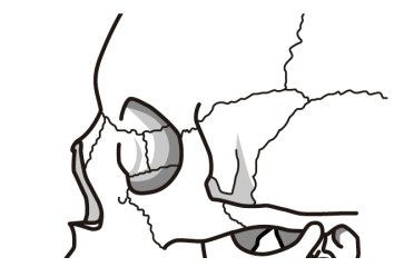 鼻の付け根の骨の構造画像